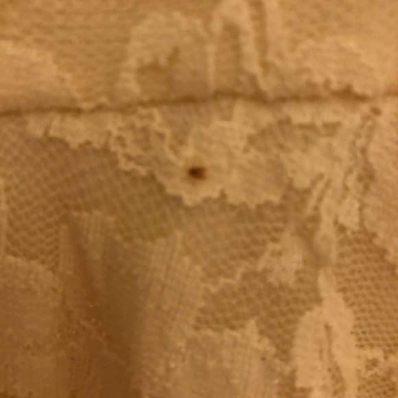 Aritzia Dillema Lace Skater Dress - Picture 7 of 16